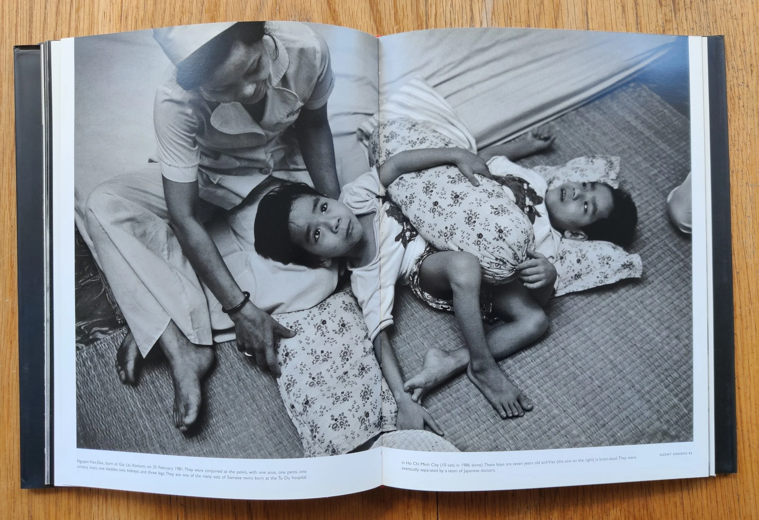 Agent Orange: "Collateral Damage" in Vietnam - Image 6