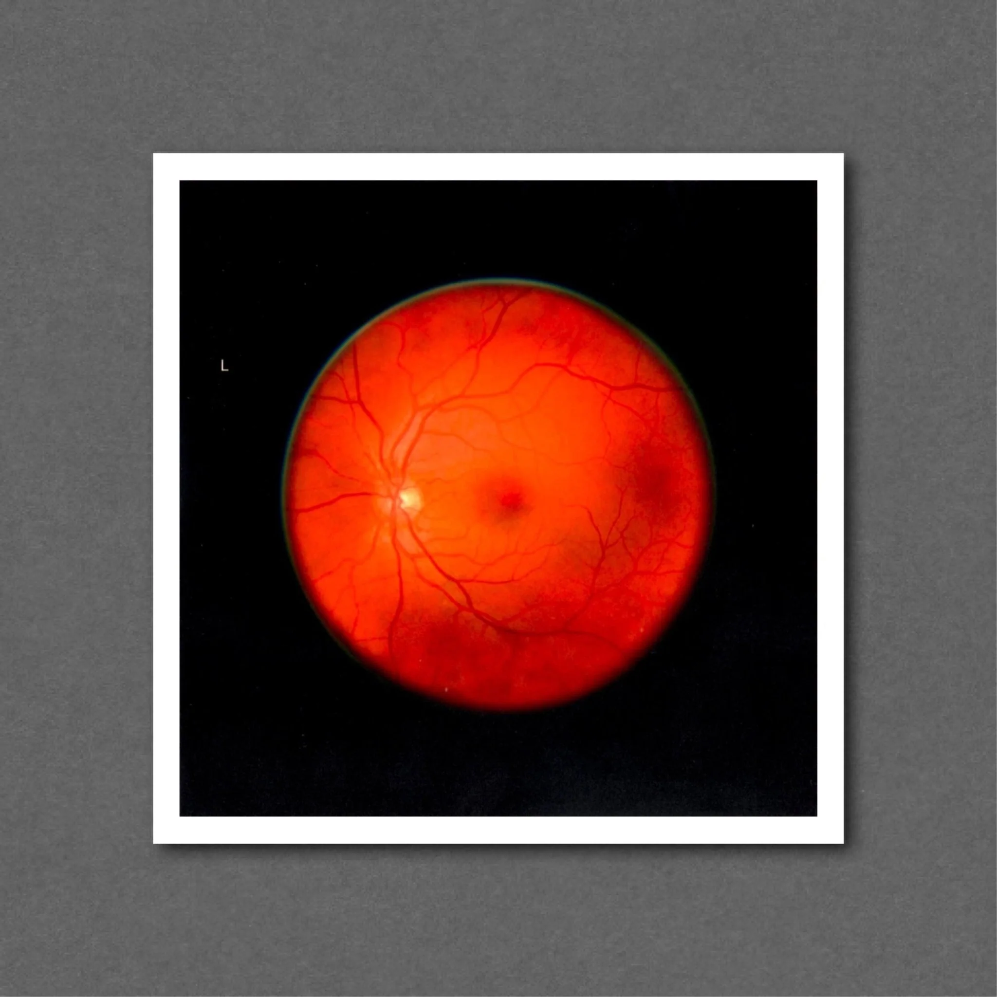 Retinal Self Portrait, Left Eye
