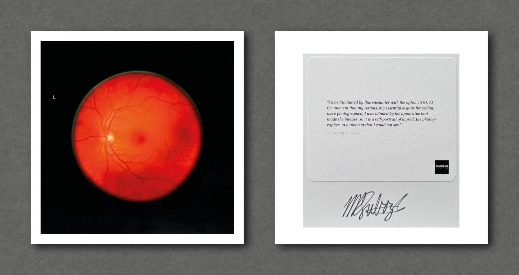 Retinal Self Portrait, Left Eye - Image 2